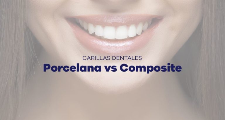 diferencias entre carillas de porcelana y carillas de composite