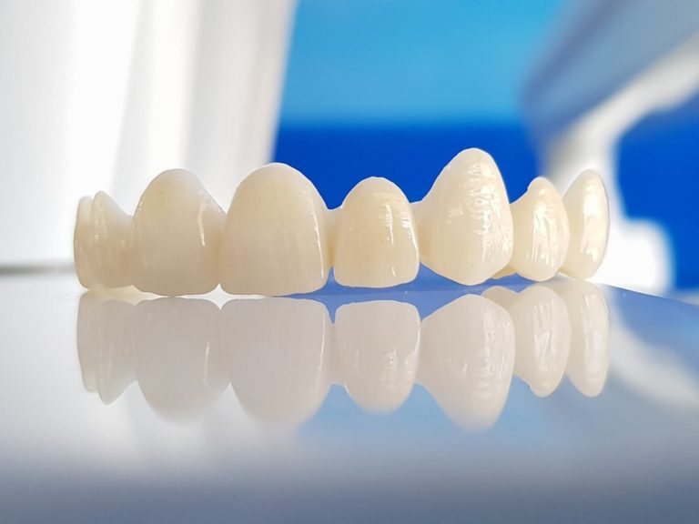 coronas de zirconio