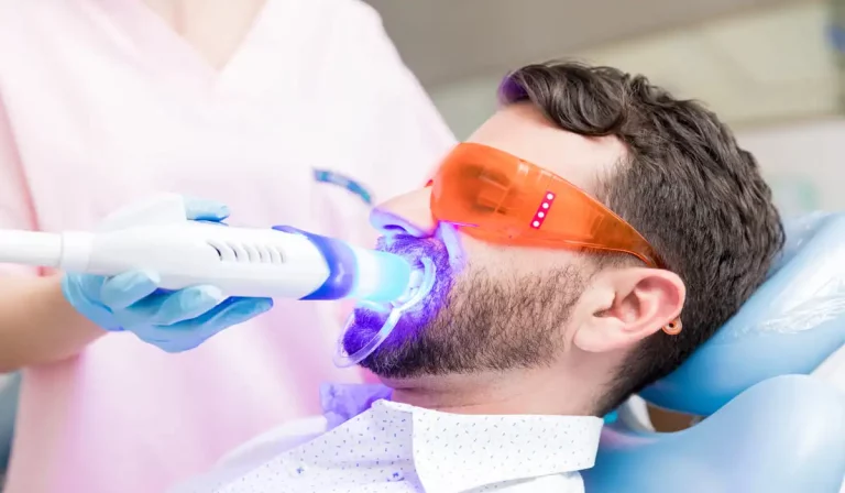 tipos de blanqueamiento dental