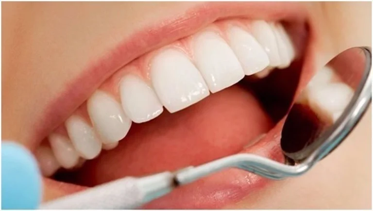 Buena higiene dental