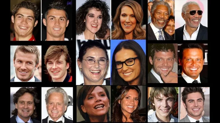 Famosos con ortodoncia invisible