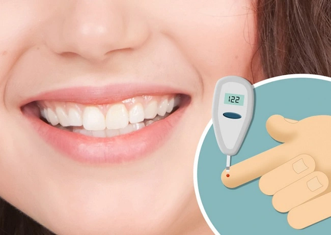 Cómo afecta la diabetes en los dientes