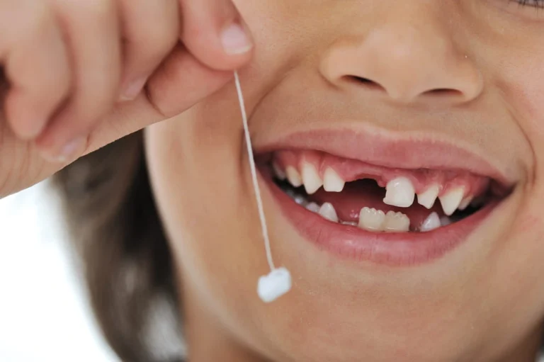 Cuáles son los dientes de leche