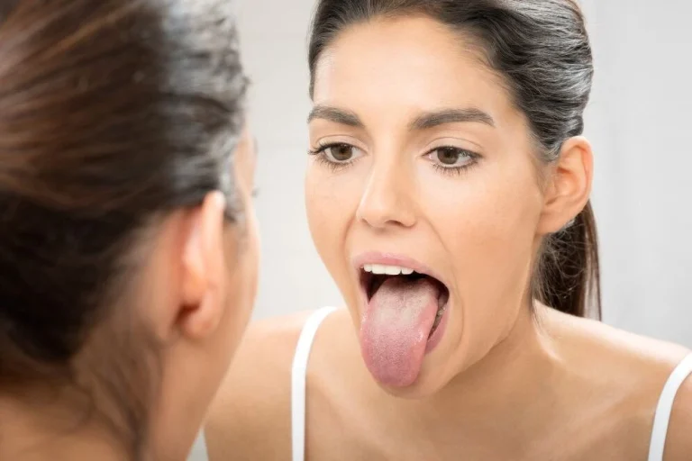 Llagas en la lengua