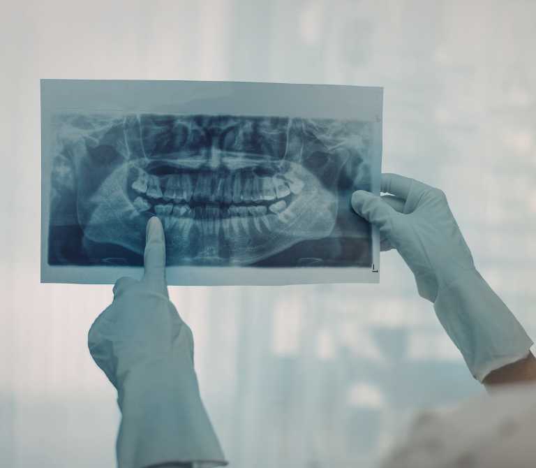 endodoncia en madrid diagnostico
