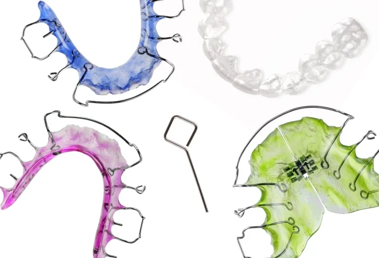 Retenedores de dientes